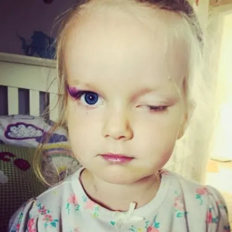 A young girl with one eye closed, wearing white pyjamas with a flower pattern.