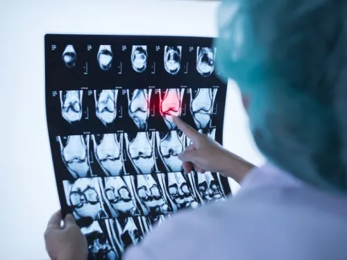 A doctor pointing at an xray